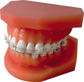 Orthodontic demonstration model discovery® pearl