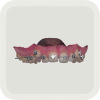 TRIOS Orthodontic Planner App