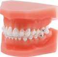 Orthodontic demonstration model discovery® pearl